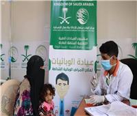 مركز الملك سلمان للإغاثة يقدم خدمات علاجية ويوزع سلال غذائية باليمن