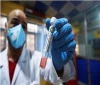 العراق يسجل 2163 حالة إصابة جديدة بفيروس كورونا