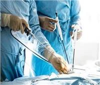 استشاري جراحة عامة يوضح العمليات التي تتم عن طريق المنظار الجراحي