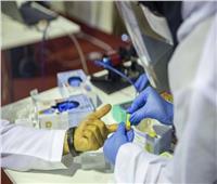 وزير الصحة الكويتي: شفاء 587 حالة مصابة بفيروس (كورونا)