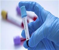 الصحة: تسجيل 167 حالة إيجابية جديدة لفيروس كورونا.. و21 حالة وفاة