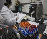 الصحة: تسجيل 168 حالة إيجابية جديدة لفيروس كورونا.. و 24  حالة وفاة