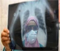 فيديو| «الصحة» عن إصابات كورونا في مصر: نحن في فترة الترقب والحذر
