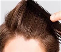 استشاري تجميل يوضح الحالات التي يُنصح لهم بزراعة الشعر 