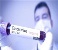 الصحة الأردنية: تسجيل 620 إصابة جديدة بفيروس «كورونا»