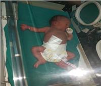 بالصور| مستشفى المنيرة ينقذ طفلا عمره 3 أيام بجراحة عاجلة