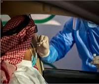 الصحة السعودية: تسجيل 348 إصابة جديدة بفيروس كورونا