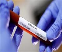 العاصمة اليابانية: تسجل 242 حالة إصابة جديدة بفيروس كورونا