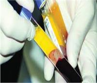 «الصيادلة»: مصر توقع اتفاقية مع كوريا في مجال تصنيع مشتقات بلازما الدم.. فيديو