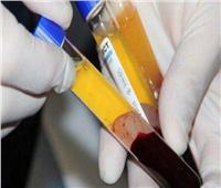 الديهي: تصنيع مشتقات بلازما الدم له خصوصية شديدة |فيديو