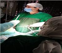 صحة الشرقية: إجراء أول جراحة مناظير بمستشفي الإبراهيمية بالمحافظة