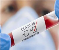 إصابات فيروس كورونا حول العالم تكسر حاجز الـ«85 مليونًا»