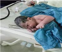 إجراء أول عملية ولادة طبيعية لمصابة بكورونا في مستشفى عزل كفر الدوار