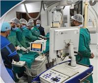 الرعاية الصحية: نجاح أول عملية توسيع للشريان الرئيسي الأيسر ببورسعيد 