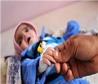 الصحة العالمية و«الملك سلمان للإغاثة» يواصلان مكافحة سوء تغذية أطفال اليمن
