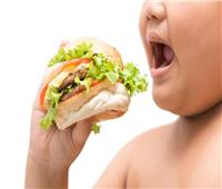 الأطفال المصابون بالسمنة والسكري أكثر عرضة للإصابة بـ «كورونا»