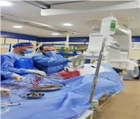 إجراء 338  قسطرة قلبية للمرضى بمستشفى الزقازيق العام 