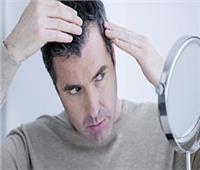 دراسة: مرضى كورونا يعانون من تساقط الشعر 