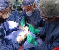 «الرعاية الصحية» تعلن نجاح أول عملية زراعة قوقعة بمستشفى السلام بورسعيد