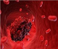 دراسة: فيتامين «ب» يمنع تجلطات الدم المرتبطة بفيروس كورونا