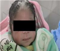 استشاري نساء وتوليد: ولادة طفلة بخصلات بيضاء «حالة وراثية»