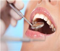 10 مسببات لـ«تآكل مينا الأسنان».. أبرزها المشروبات الغازية