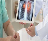 «الصحة» تنصح بإتباع 8 إرشادات للوقاية من الأمراض الصدرية