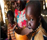 الركود الاقتصادي بسبب جائحة «كورونا» سيزيد من سوء التغذية في العالم