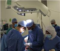 فريق طبي ينقذ حياة طفل أقصري بـ«عملية قلب مفتوح» ببورسعيد