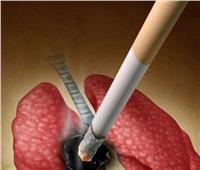 «حسام موافي» يكشف عن علاقة السرطان بالتدخين.. فيديو 