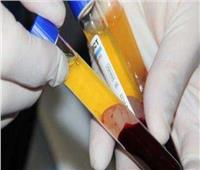 «قومي الكبد» يوضح أهمية قانون تنظيم عمليات الدم وتجميع البلازما| فيديو