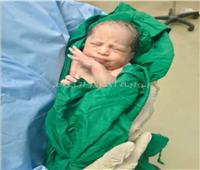 نجاح عملية ولادة قيصرية لمريضة كورونا بمستشفى العزل بكفر الدوار | صور