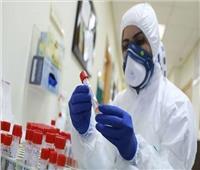 الصحة الإماراتية: تسجيل 1847 إصابة جديدة بفيروس كورونا