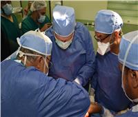 نجاح عملية فصل التؤام البوروندي الملتصق بمستشفيات جامعة عين شمس