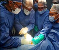 فريق طبي بالفيوم ينجح فى استخراج آلة حادة داخل عنق طفل خلال مشاجرة 