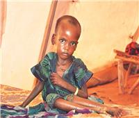 مرض وموت محتمل للأطفال.. سوء التغذية يهدد إقليم تيجراي الإثيوبي