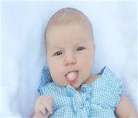 احذري «الكانديدا».. 5 أعراض لفطريات الفم عند الرضع