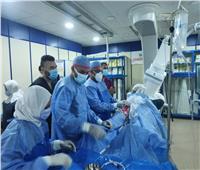 إجراء قسطرة قلبية لـ 583 مريضا بمستشفى الزقازيق العام 
