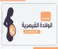 إنفوجراف| أرقام عن الولادة القيصرية في مصر