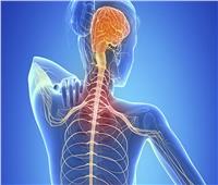 التصلب العصبي (MS).. يهاجم الأعصاب ويسبب الاكتئاب وفقدان الحركة  