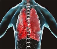 علماء أمريكيون يتوصلون لأسباب الإصابة بسرطان الرئة بين غير المدخنين