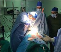 المنوفية: إجراء 77 عملية جراحية بالقلب لغير القادرين بالمجان