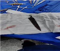 فريق طبي ينجح فى إخراج سكين اخترقت صدر مريض في السويس