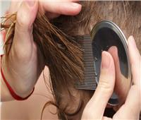  قبل دخول المدارس.. 6 نصائح طبيعية للتخلص من حشرات الشعر