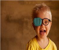 استشاري عيون: «الحول» قد يؤدي لفقدان البصر نهائيًا
