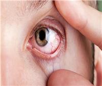 دراسة: أكتشاف علاج فعال لسرطان العين القاتل 