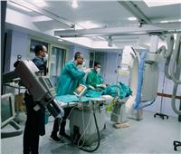 «قنا العام» ينجح فى إجراء أول عملية قسطرة مخية بمستشفيات الصعيد