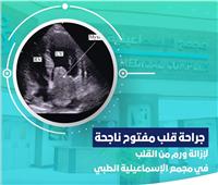 «المجمع الطبي بالإسماعيلية» ينجح فيجراحة وإزالة ورم داخل قلب مريضة