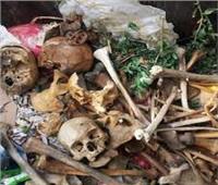 «الداخلية» عن العثور على جماجم بشرية داخل القمامة: «خاصة بطلبة الطب»