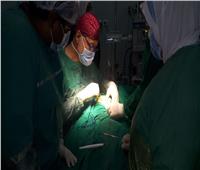 صحة القاهرة: جراحات دقيقة ونادرة للأطفال والمبتسرين في مستشفى المنيرة العام